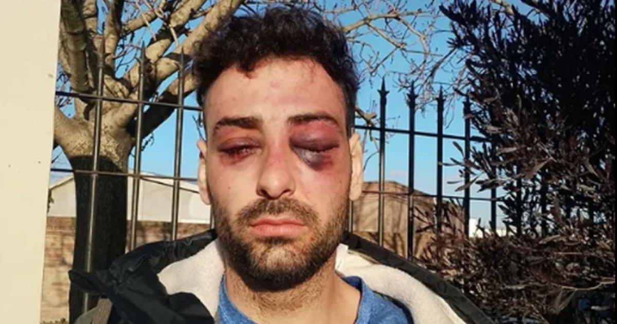 Pasaron a pasiva a los siete policías que golpearon al músico y luthier en Santa Rosa